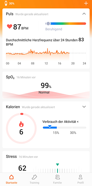 Xiaomi Mi Smart Band 7 - Zepp Life App - Blutsauerstoff, Stress, Kalorien